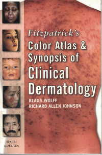 Image of Fitzpatrick's Color Atlas and Synopsis of Clinical Dermatology