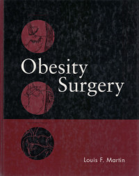 Image of Obesity Surgery