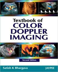 Image of Textbook of Color Doppler Imaging