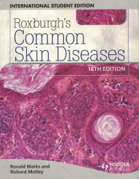Image of Roxburgh's Common Skin Diseases