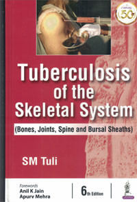 Image of Tuberculosis of the Skeletal System